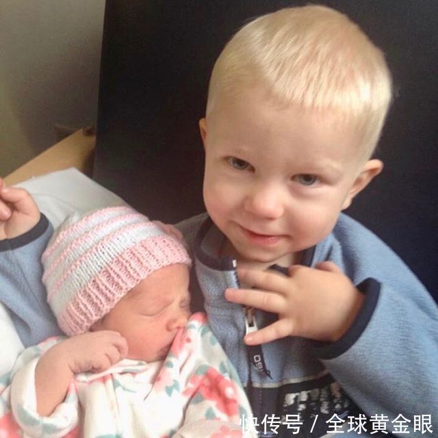  依旧|美6岁男孩为保护妹妹与恶狗搏斗，缝90针笑容依旧，获“绿巨人”盛赞