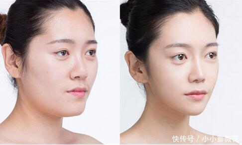 脸型|国字脸怎么改变脸型，国字脸改脸型价格太高了？