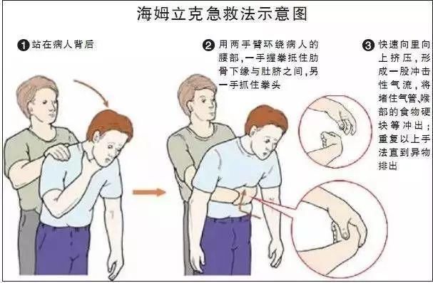 中山医院|男子胸闷气促两个多月，原来是支气管被猪骨头”塞住“了