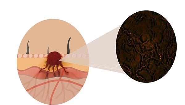  癌细胞|癌细胞是被坏习惯喂养出来的！远离癌症，哪些习惯要及时改正？