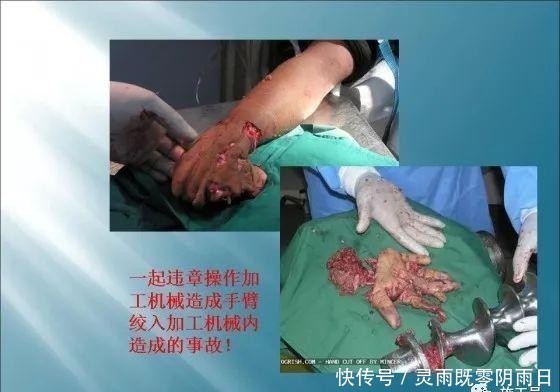 事故|建筑施工现场事故案例分析图文