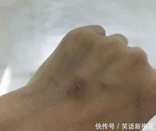  马蜂|“被这么大的马蜂蜇了，我还有机会吗？”哈哈哈找个阴凉地躺下吧