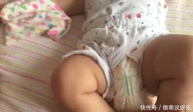 一家人|8个月宝宝的腿纹不一致,一家人发现的太晚,结果错过最佳治疗期