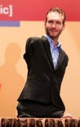 出生|国外男子一出生就吓吐了父亲,现在却能影响整个社会