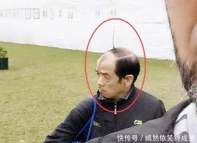 无奈|搞笑图片幽默段子笑话:哈哈,老兄你的头是怎么回事啊,无奈了哦