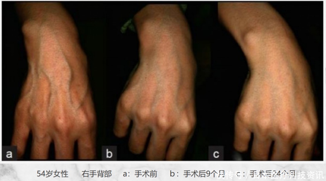  治疗|日本最先端保养品，干细胞上清液！