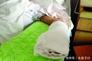 做梦吃猪蹄啃手|一男子做梦吃猪蹄，醒了却赶紧送医院，背后真相让人惊呆了