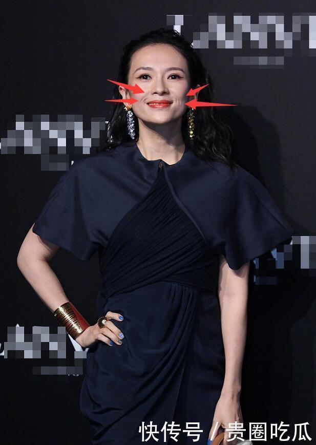 奇怪|章子怡二胎影响大,产子后首现身法令纹奇怪,发际线退后