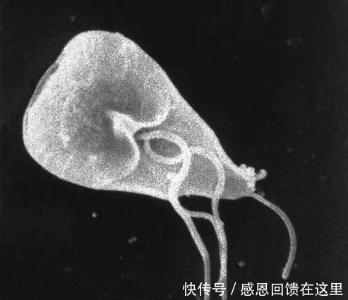  虫子|男子被吃脑虫入侵20天后病逝, 提醒: 这几种常见寄生虫得小心