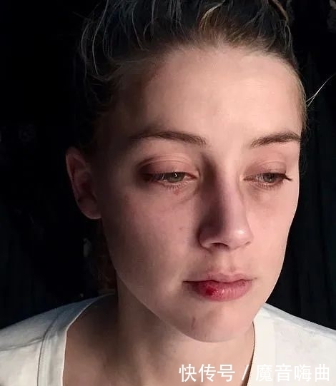  用头撞|庭审第三天：德普承认婚后出轨并对前妻使用暴力，海后曾帮他戒毒